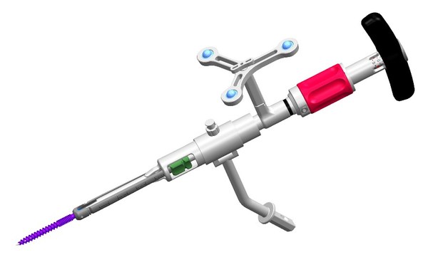 強生醫(yī)療的微創(chuàng)內(nèi)植入系統(tǒng)Viper Prime(TM) 強生醫(yī)療的微創(chuàng)內(nèi)植入系統(tǒng)Viper Prime(TM)