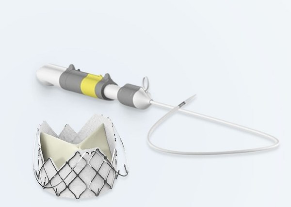 圖為J-Valve經血管介入生物心臟瓣膜置換系統