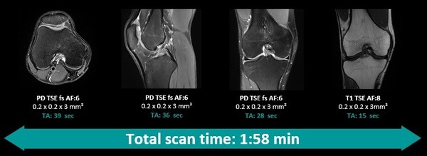 應(yīng)用Deep Resolve，超高分辨率完整膝關(guān)節(jié)掃描可在2分鐘以內(nèi)完成，并提供高信噪比圖像