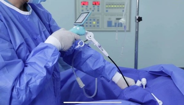 博鰲首例一次性電子膀胱鏡落地，膀胱腫瘤檢查迎來新選擇