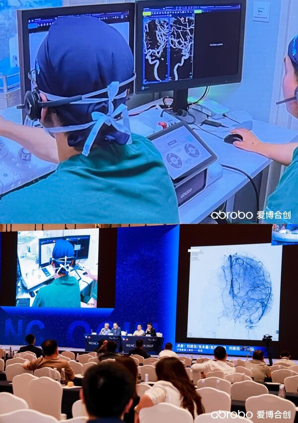 神經(jīng)介入手術(shù)現(xiàn)場直播演示