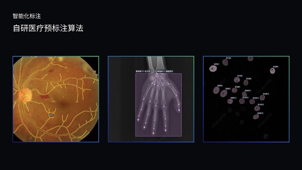 澳鵬MediGo平臺(tái)集成醫(yī)療專用NER模型、問答對(duì)自動(dòng)生成系統(tǒng)和自研預(yù)標(biāo)注算法