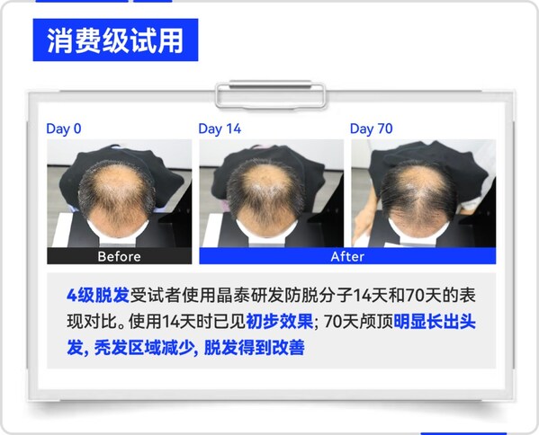 晶泰科技 AI 研發(fā)生發(fā)分子消費(fèi)級試用效果案例